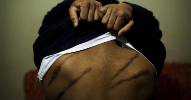 ශ්‍රේෂ්ඨාධිකරණ තීන්දුවක්: දරුවකුගේ ඇසට නයි මිරිස් දියර දැමූ පොලිස් ස්ථානාධිපති වරදකරුවේ; පොලිස්පතිට නව නියෝගයක්